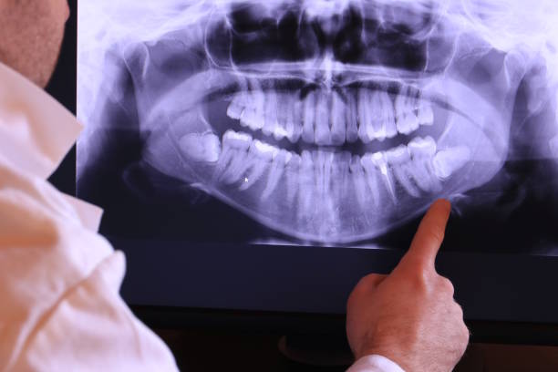 Best Urgent Care for Lost Fillings or Crowns in Denmark, SC