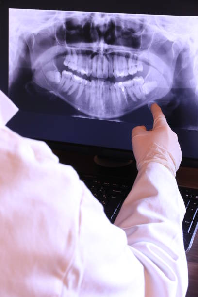 Best Emergency Tooth Extraction in Denmark, SC