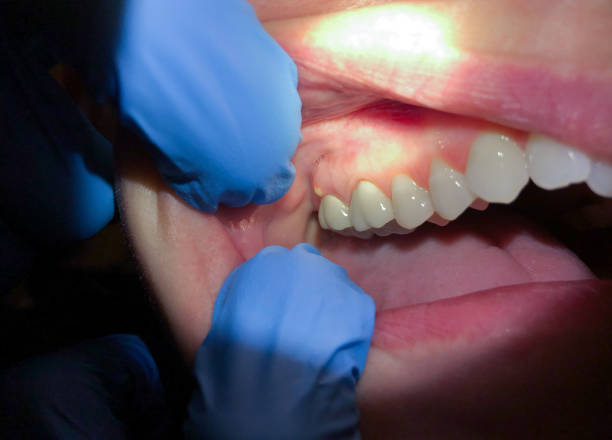 Best Emergency Denture Repair in Denmark, SC